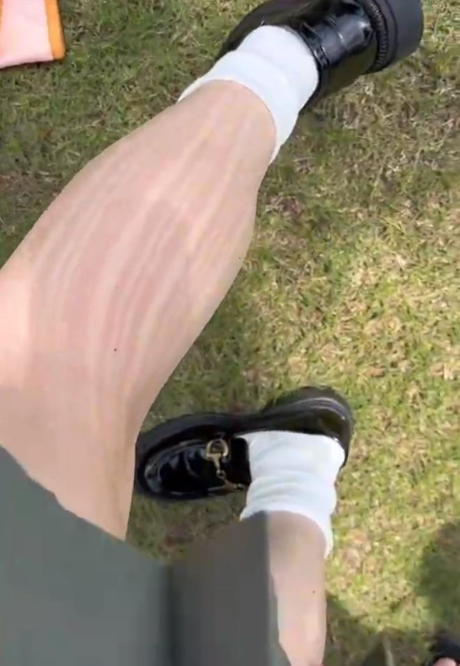 女生穿白色丝袜拍照两小时,喜提“半永久纹身”:烈日太毒太晒